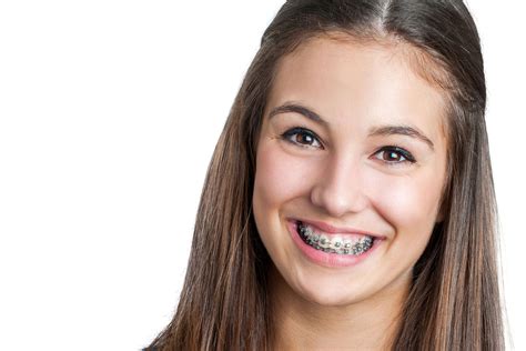 Braces Vs Invisalign D Spa Dental