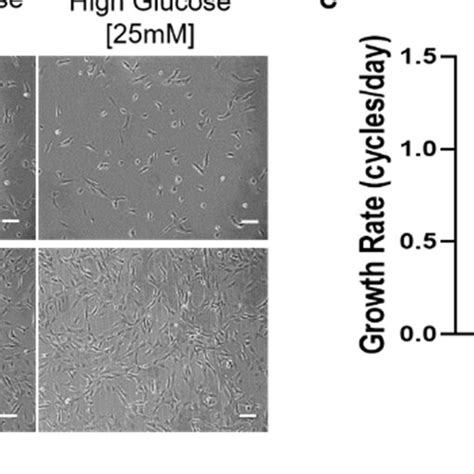 Effect Of Hyperglycemia On Ipsc Derived Myoblast Proliferation A