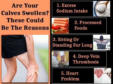 Are Your Calves Swollen? These Could Be The Reasons - Boldsky.com