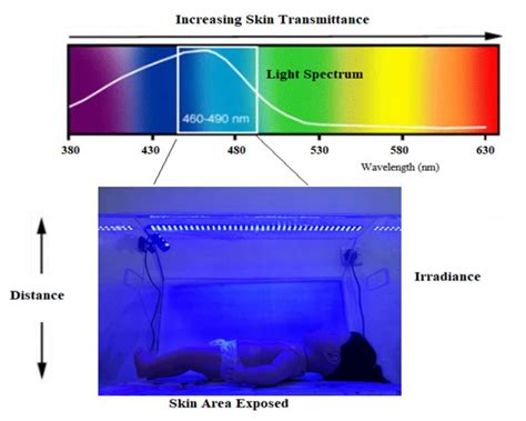 Types Of Phototherapy Lights For Jaundice Shelly Lighting