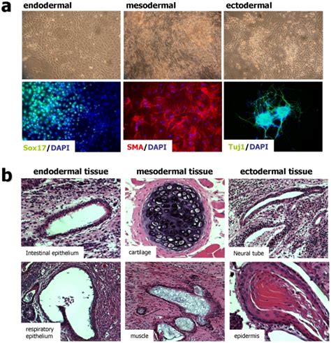 A Embryoid Body Eb Mediated In Vitro Differentiation Of Rat Ips