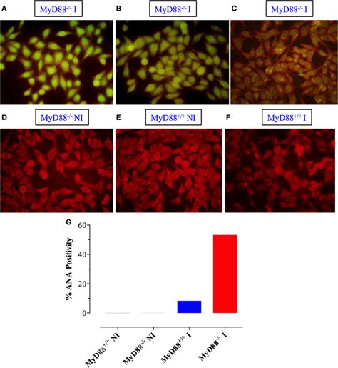 Qualitative Detection Of Antinuclear Antibodies Ana By