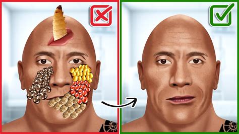 ASMR Remove Ticks And Maggot Infected From The Rock Dwayne Johnson