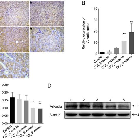 Ccl 4 Induced Hepatic Fibrosis In Rats Following Ccl 4 Injection Rats