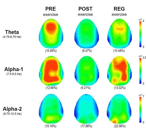 Topography Of Eeg Power Over The Scalp Average In Theta Alpha 1