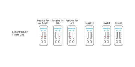 Typhoid Rapid Iggigm Combo Test Reszonics