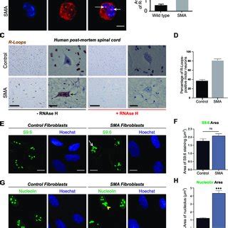 Accumulation Of R Loops In Survival Motor Neuron Smn Deficient Cells