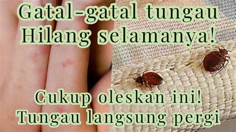 Cara Mengatasi Gatal Gatal Tungau Pengalaman Pribadi 100 Dapat