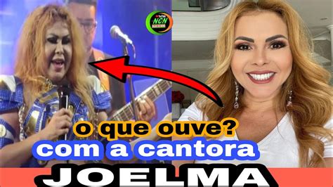 Entenda Tudo O Que Aconteceu O Rosto Da Cantora Joelma Ex Banda