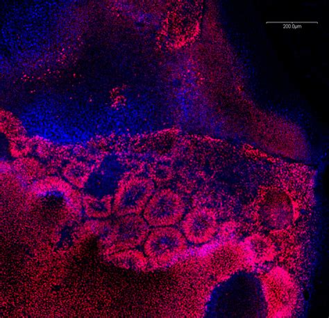 Image of the week: Retinal pigment epithelium precursor cells - Scope