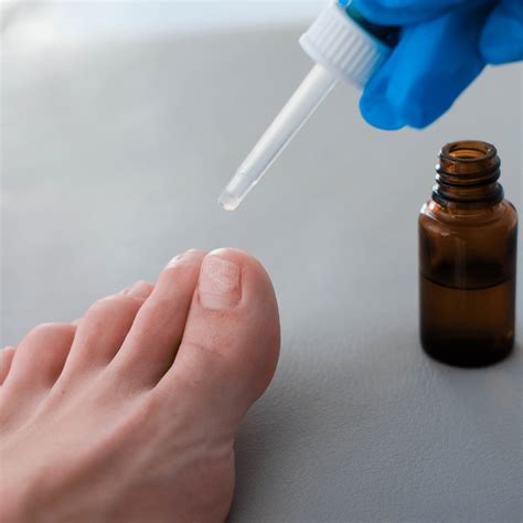 Fungal Nails Understanding And Treating Onychomycosis Elite Foot Care