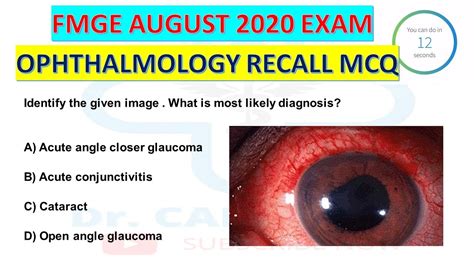 OPHTHALMOLOGY FMGE 2020 AUGUST EXAM FMGE RECALL MCQ Image Based