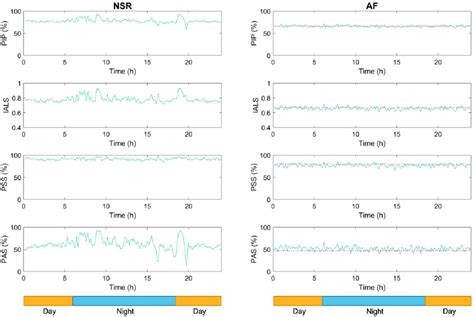 Circadian Rhythm Of Heart Rate Fragmentation Metrics In A Patient With