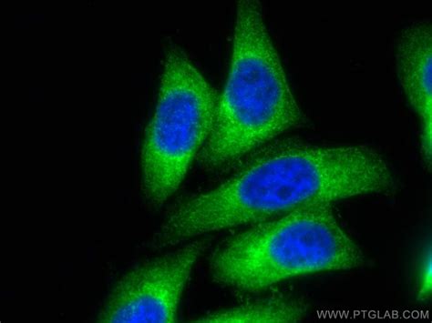 Mars Monoclonal Antibody E B Coralite Proteintech L