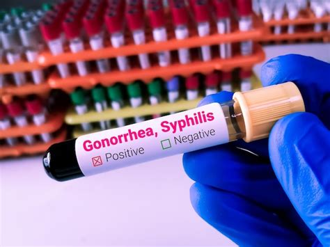 Premium Photo Doctor Holding A Blood Sample For Syphilis And