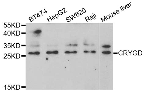 Anti CRYGD CCP Antibody Rabbit Anti Human Polyclonal IHC WB LSBio