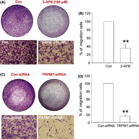 Suppression Of Trpm7 Inhibits Proliferation Migration And Invasion Of