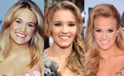 Carrie Underwood Plastic Surgery Before and After Pictures 2018