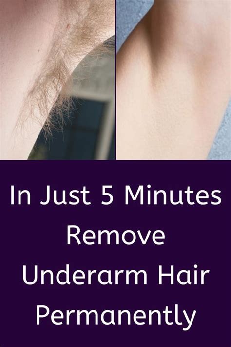 Remove Underarms Hair Permanently In Just 5 Minutes Underarm Hair