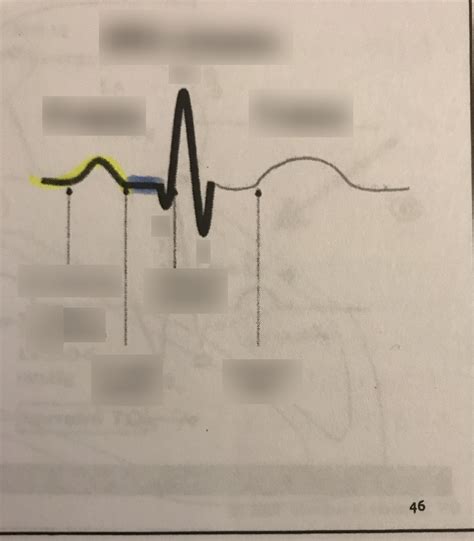 Ekg Diagram Quizlet