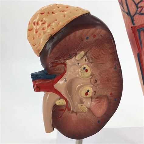 Medical Nephron Glomerulus Enlarged Kidney Anatomy Human Kidney Model