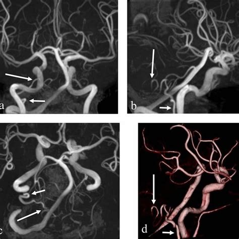 Antero Posterior A Right Lateral B And Inferosuperior C Projections Of