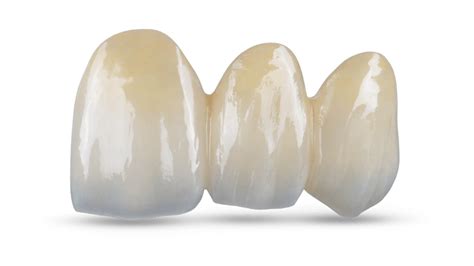 Bruxzir Esthetic Zirconia Glidewell Dental México