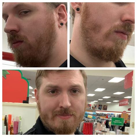 Any helpful tips on fixing patches? Been growing for about 2 month and