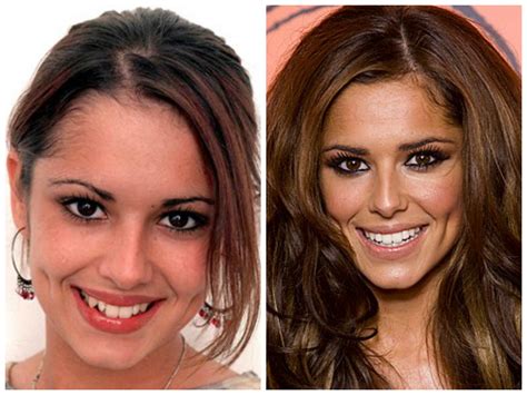 Celebrities with Veneers | My Porcelain Veneers