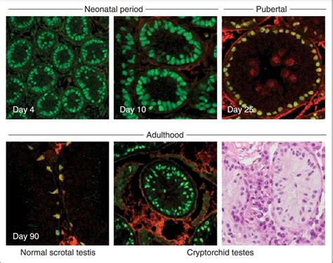 Maturation Dependent Change In Sertoli Cell Nuclear Protein Expression