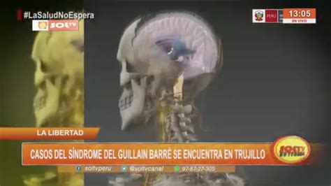 Alerta por Aumento de Guillain Barré en Trujillo