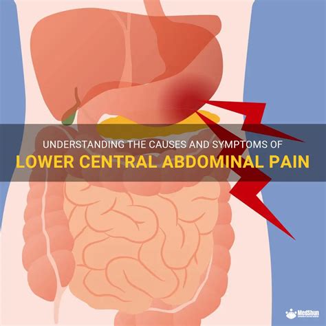 Understanding The Causes And Symptoms Of Lower Central Abdominal Pain