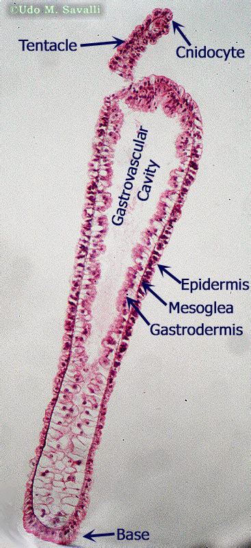 BIO385 Cnidaria