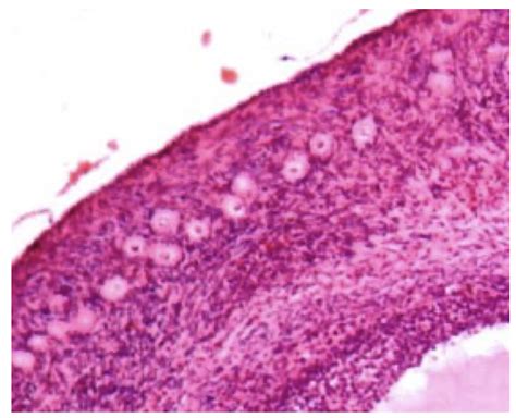 Histology of the primordial follicle Diagram | Quizlet