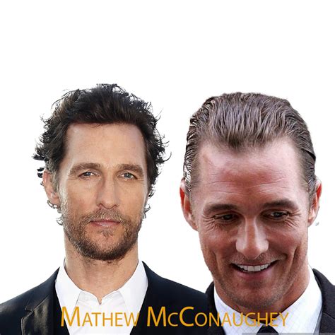 Matthew McConaughey Hair Transplant A Journey of Transform