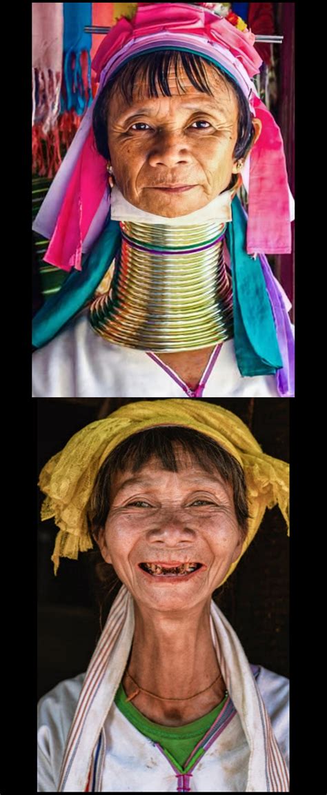 Woman From Kayan Tribe Of Myanmar With And Without The Traditional Neck