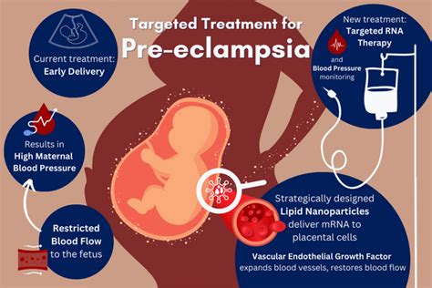 Lipid Nanoparticles In Treating Preeclampsia Medical Automation