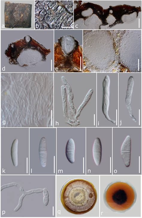 Delonicicola Siamense Facesoffungi Number Fof 03606 Faces Of Fungi