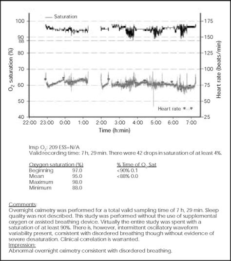 Use Of Ambulatory Overnight Oximetry To Investigate Sleep Apnea In A