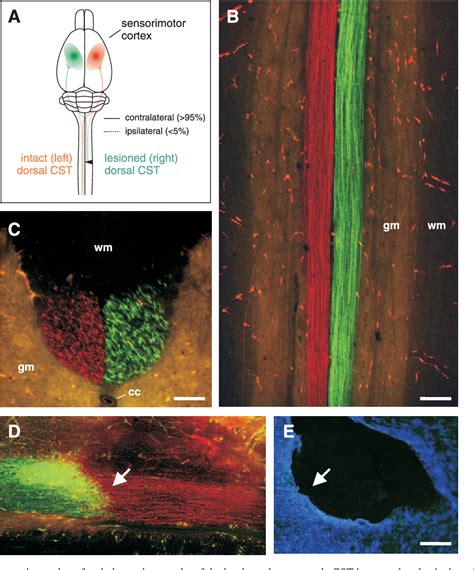 PDF NT 3 Expression From Engineered Olfactory Ensheathing Glia