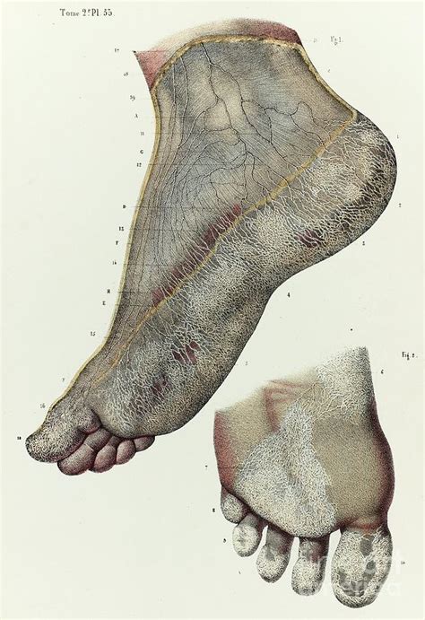 Foot Lymphatic Vessels Photograph By Science Photo Library