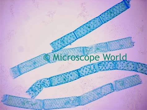 Microscope World Blog Spirogyra Under The Microscope