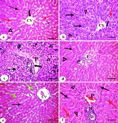 Hematoxylin And Eosin Stained Liver Sections Showing A Control Group