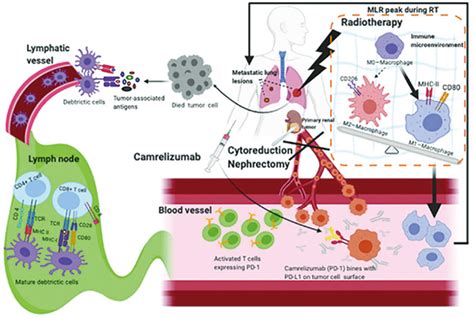 可切除的ⅢaⅢb期nsclc 卡瑞利珠单抗联合新辅助化疗显著改善pcr 全球肿瘤快讯