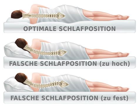 Wecken Stra E Schalter Morbus Bechterew Matratze Pornographie Susteen