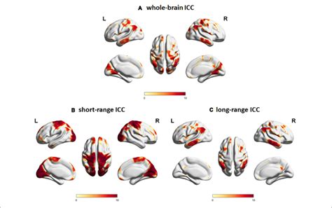 Intrinsic Connectivity Contrast Icc Maps For A Whole Brain