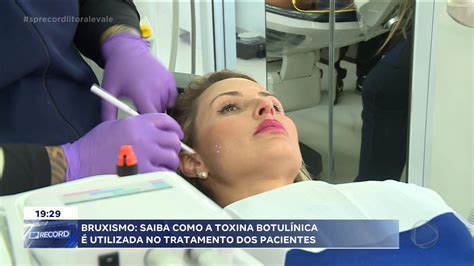 Bruxismo causa dores de cabeça e desgaste na dentição Record TV