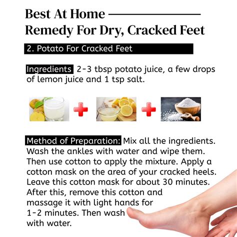 Home Remedies Dry Cracked Hands