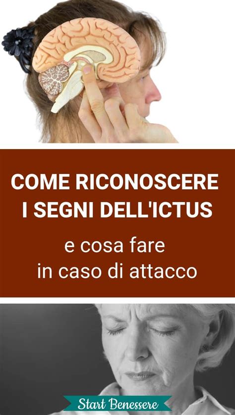 Come Riconoscere I Segni Dell Ictus E Cosa Fare In Caso Di Attacco