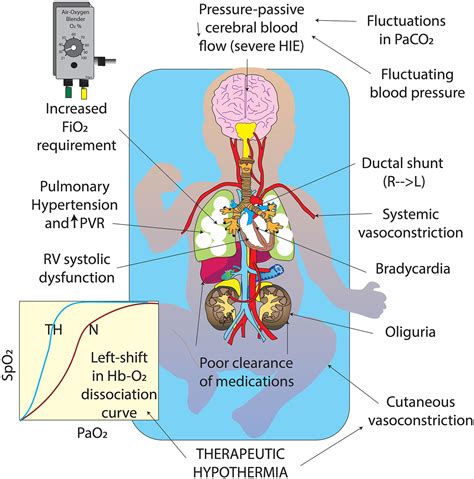 Hemodynamic Optimization For Neonates With Neonatal Encephalopathy